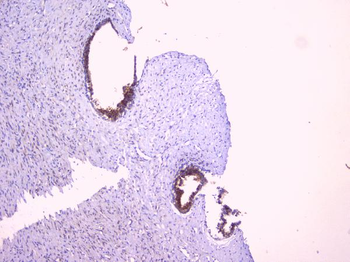 Anti-PBP/PEBP1 Antibody