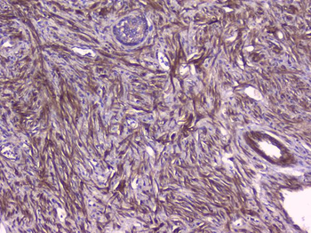 Anti-PBP/PEBP1 Antibody