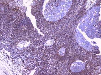 Anti-PBP/PEBP1 Antibody