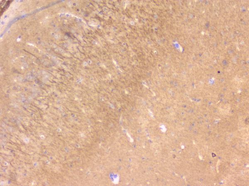 Anti-PBP/PEBP1 Antibody