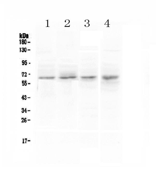Anti-CCKBR Antibody