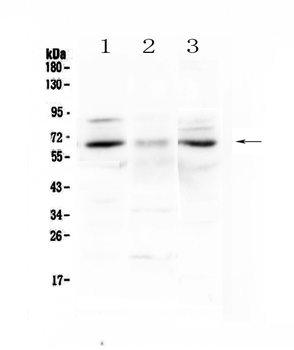 Anti-CCKBR Antibody