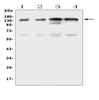EPS15 Rabbit Polyclonal Antibody