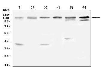 Anti-EPS15 Antibody