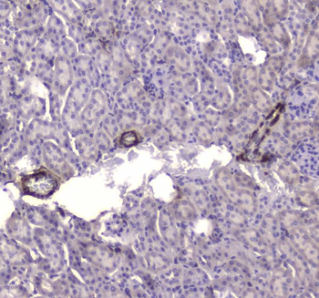 Anti-Creatine kinase B type/CKB Antibody