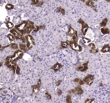Anti-Creatine kinase B type/CKB Antibody