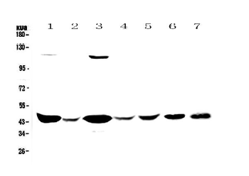 Anti-Creatine kinase B type/CKB Antibody