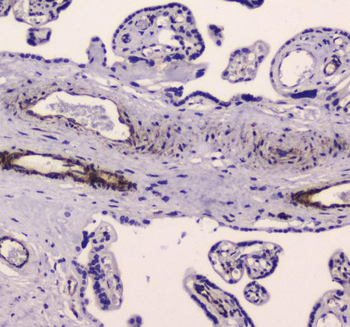 Anti-Myosin light chain kinase/MYLK Antibody