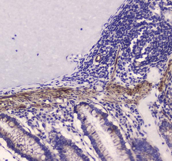 Anti-Myosin light chain kinase/MYLK Antibody