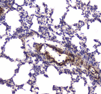 Anti-Myosin light chain kinase/MYLK Antibody