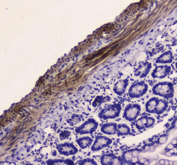 Anti-Myosin light chain kinase/MYLK Antibody