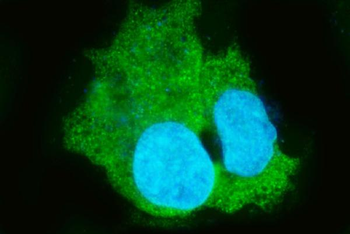 Anti-Liver Carboxylesterase 1/CES1 Antibody