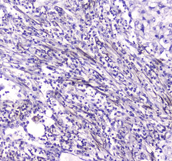Anti-Liver Carboxylesterase 1/CES1 Antibody