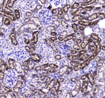 Anti-Liver Carboxylesterase 1/CES1 Antibody
