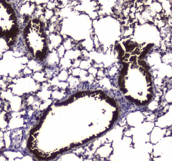 Liver Carboxylesterase 1/CES1 Antibody
