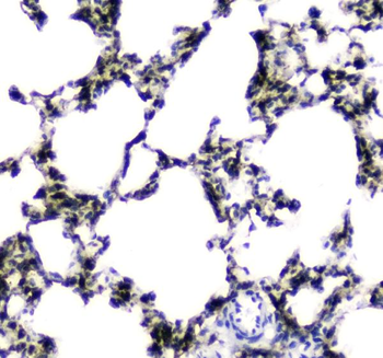 Anti-Liver Carboxylesterase 1/CES1 Antibody