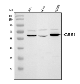 Anti-Liver Carboxylesterase 1/CES1 Antibody