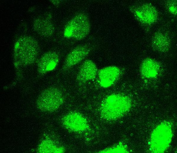 Anti-RUNX1T1/ETO Antibody