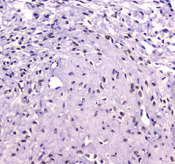 Anti-RUNX1T1/ETO Antibody