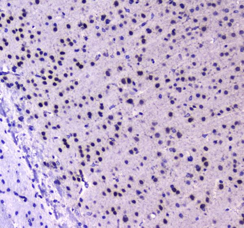 Anti-RUNX1T1/ETO Antibody