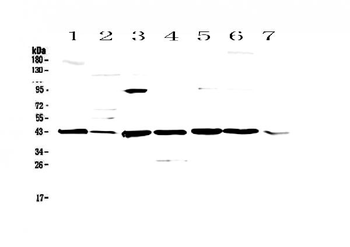 Anti-Caspase 4/Casp4 Antibody