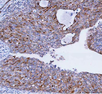 Anti-TACI/TNFRSF13B Antibody