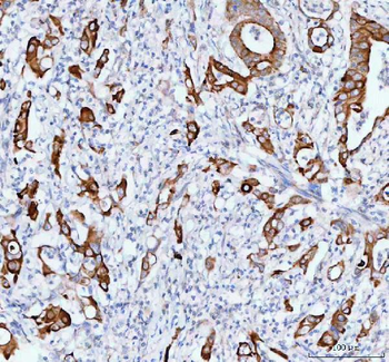 Anti-TACI/TNFRSF13B Antibody