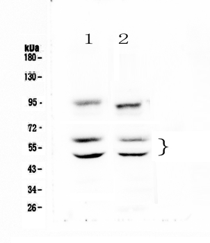 CaMKII alpha/CAMK2A Antibody