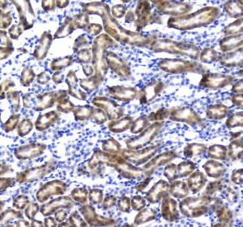 Anti-Regucalcin/RGN Antibody