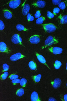 Anti-TCP1 eta/CCT7 Antibody