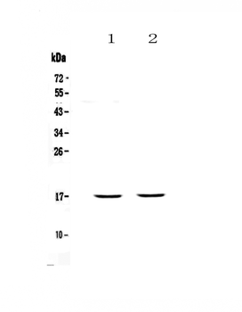 PLAC9 Rabbit Polyclonal Antibody