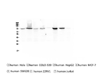 beta Catenin CTNNB1 Antibody (monoclonal, 1F6)