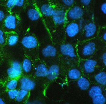 Anti-beta Catenin CTNNB1 Antibody (monoclonal, 1F6)