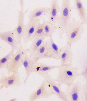 Anti-beta Catenin CTNNB1 Antibody (monoclonal, 1F6)