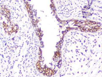 Anti-beta Catenin CTNNB1 Antibody (monoclonal, 1F6)