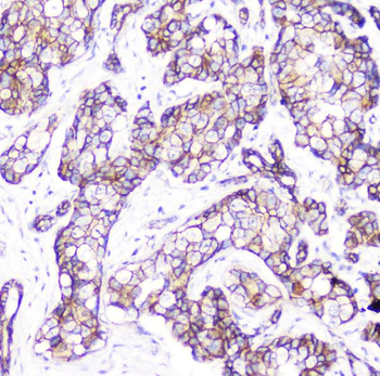 Anti-beta Catenin CTNNB1 Antibody (monoclonal, 1F6)