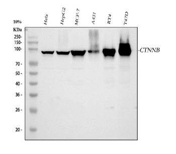 Anti-beta Catenin CTNNB1 Antibody (monoclonal, 1F6)