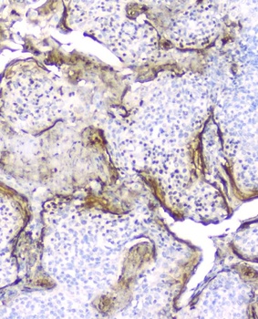 Elafin/Skalp PI3 Antibody (monoclonal, C7)