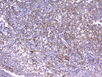 CD18 ITGB2 Antibody (monoclonal, 1A3/2A10)