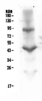CD18 ITGB2 Antibody (monoclonal, 1A3/2A10)