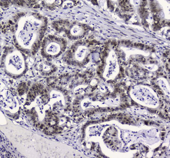 Anti-APE1 APEX1 Antibody (monoclonal, 5C11)