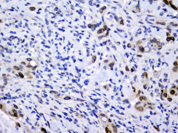 Anti-Emerin EMD Antibody (monoclonal, 5A10)