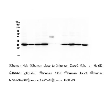 Anti-Emerin EMD Antibody (monoclonal, 5A10)