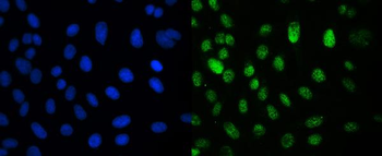 Anti-CRM1 XPO1 Antibody (monoclonal, 5G3)