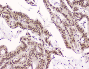 Anti-CRM1 XPO1 Antibody (monoclonal, 5G3)