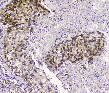 Anti-CRM1 XPO1 Antibody (monoclonal, 5G3)
