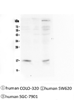 FHIT Antibody (monoclonal, 26H7)
