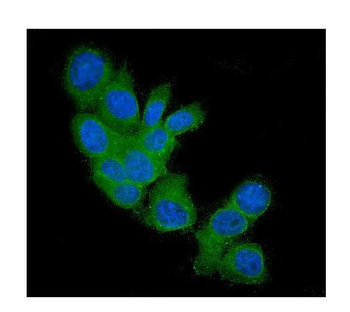 Anti-FHIT Antibody (monoclonal, 26H7)