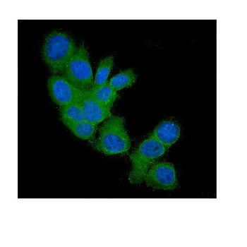 FHIT Antibody (monoclonal, 26H7)