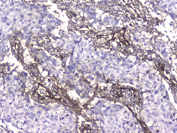 Collagen IV COL4A1 Antibody (monoclonal, 3G3)